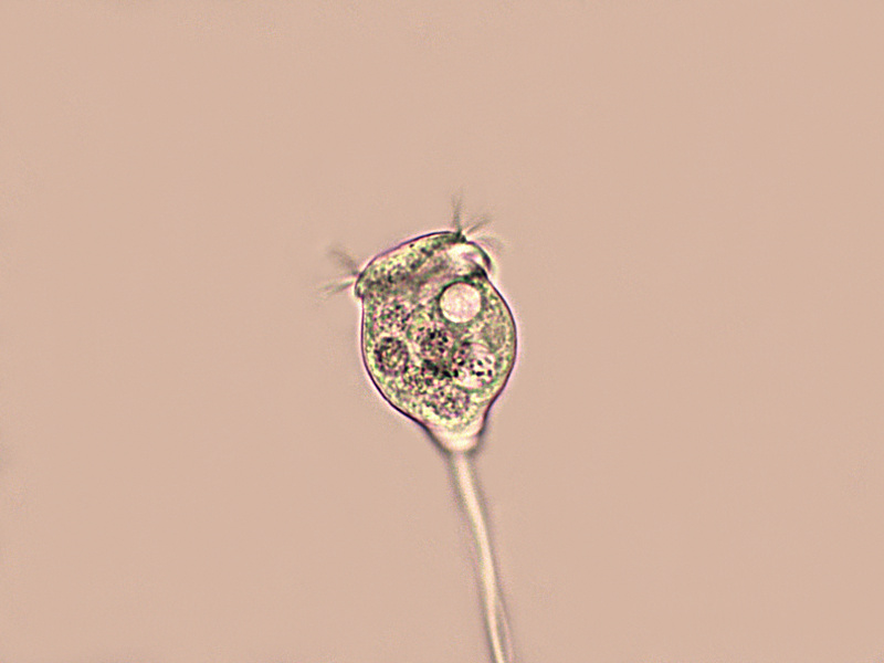 Vorticella